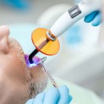 ¿Qué es una endodoncia? Te lo contamos paso a paso