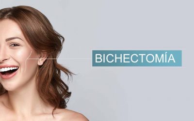 Bichectomía, el secreto del rostro perfecto