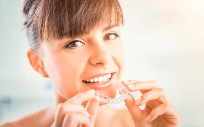 Las 10 cosas que debes saber sobre la ortodoncia Invisalign