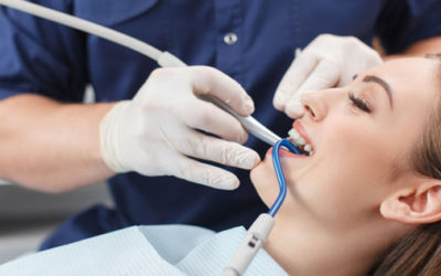 ¿Por qué debes hacerte una revisión dental periódica?