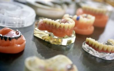 Tipos de prótesis dentales