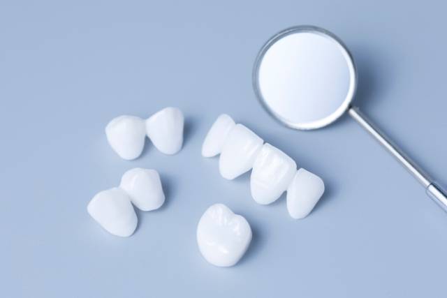 carillas dentales de porcelana o de composite