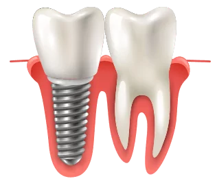 Descubre los talleres que organizamos en nuestra Clínica Dental en La Vaguada